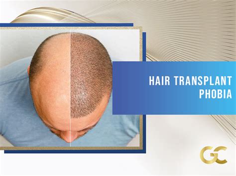 triple phobia|hair transplant triple phobia.